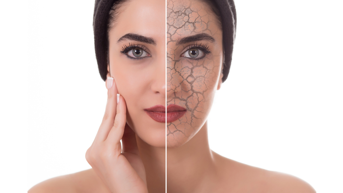 Winterize Your Skin